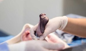 Indonesia telah mengimplementasikan Civil Registration and Vital Statistic atau disingkat CRVS. Padanannya dalam bahasa Indonesia adalah Statistik Hayati.